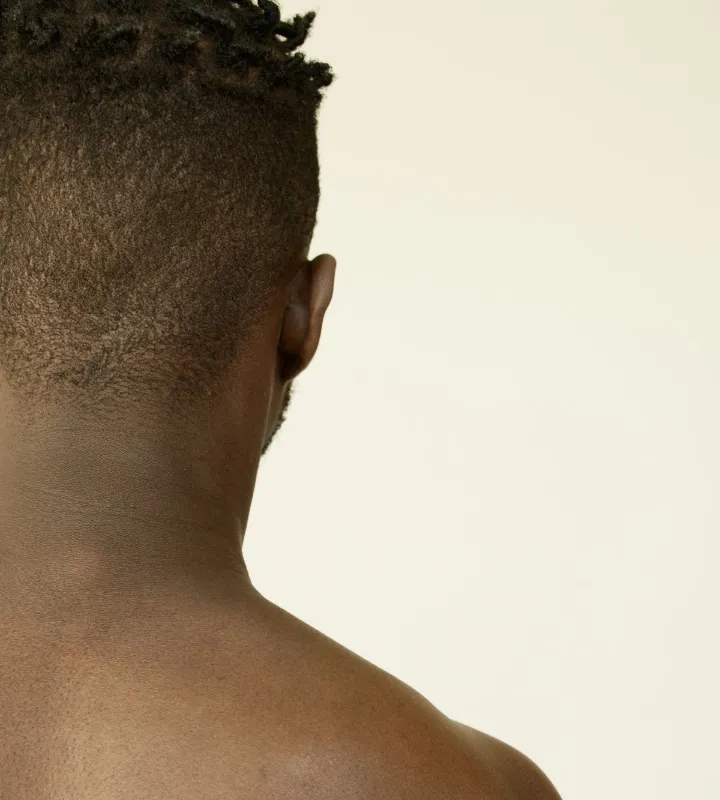 Épilation laser du dos et des épaules pour homme