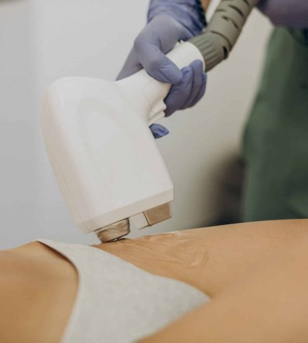 Laser epilation, hair removal therapy