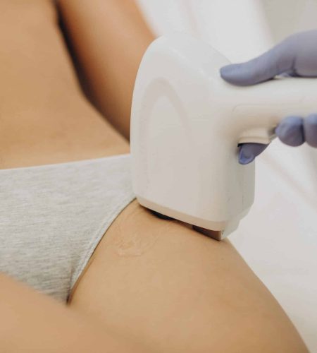 Laser epilation, hair removal therapy