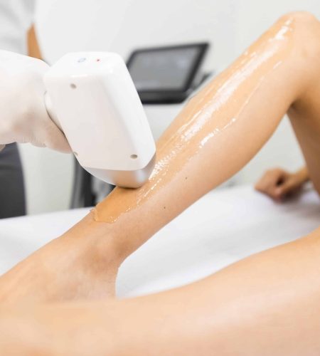 gel sur jambe de femme pour epilation au laser