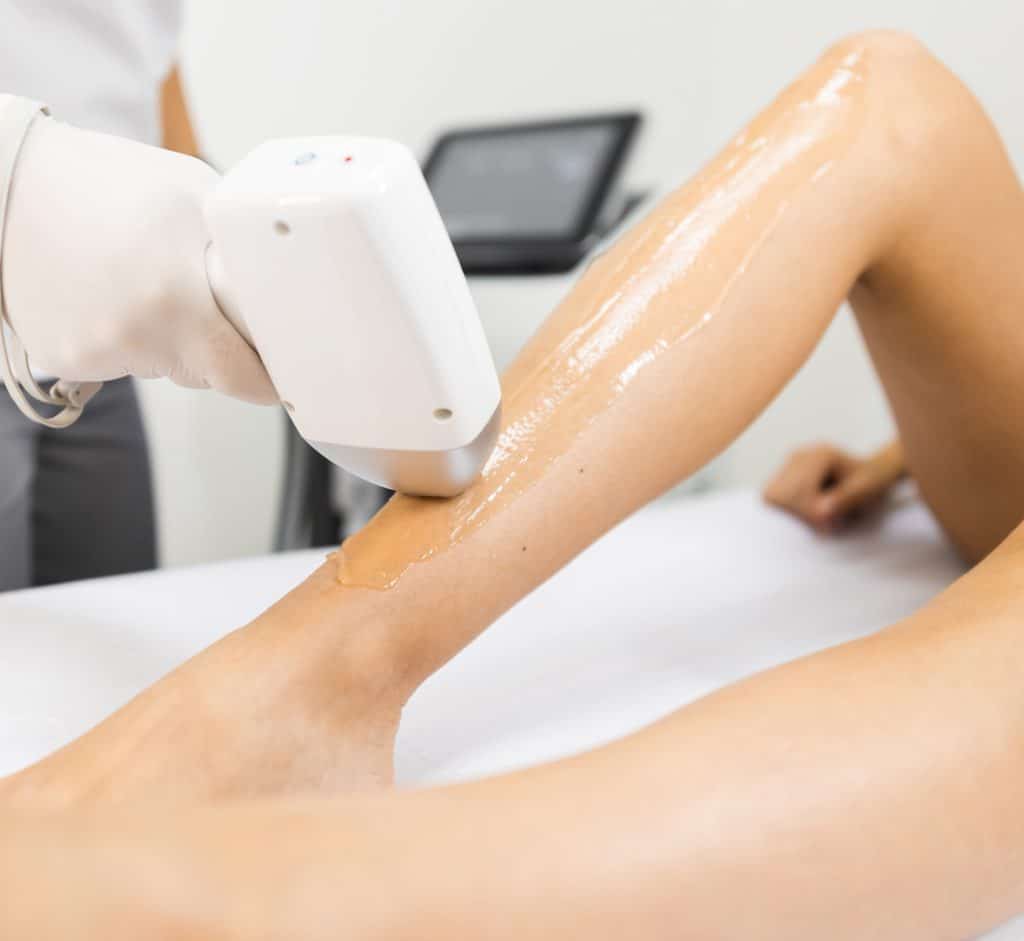 gel sur jambe de femme pour epilation au laser